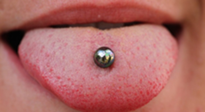 Oral piercing