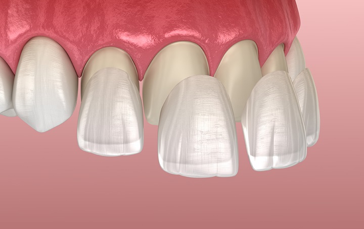 Rare photo of teeth shedding its skin